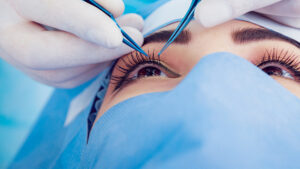 blepharoplasty eyelid surgery lid lift oculoplastic surgeon puffy eye tired eye eye rejuvenation